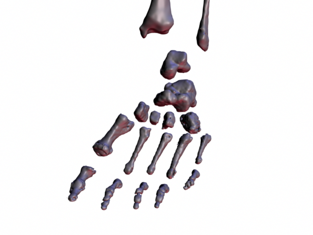 separate lower leg bones